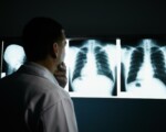 Esami radiologici, il 60% degli italiani non riceve informazioni utili