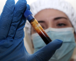 Hantavirus: 12 contagi, caso nei Paesi Bassi e oltre 600 contatti monitorati