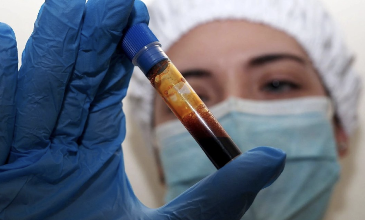 Norovirus sulla nave Ambition: cos’è il virus che ha bloccato oltre 1000 passeggeri a Bordeaux